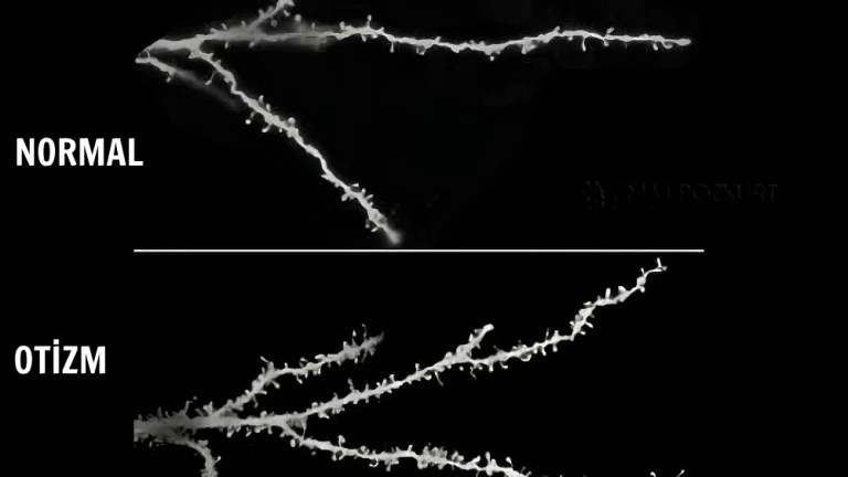 Sinaptik Budama Glial Hücreler ve Mikroglia Fagositozu