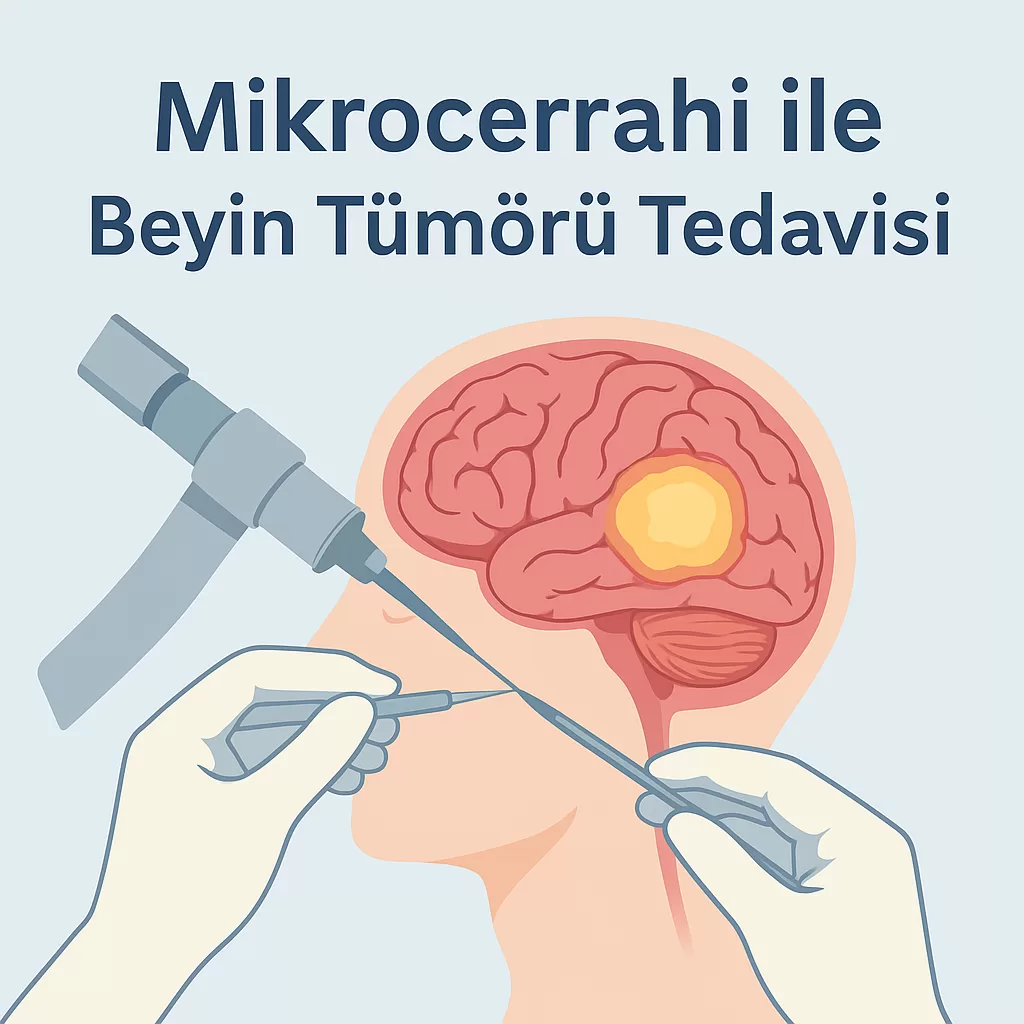 mikrocerrahi beyin tümörü risk ankara navigasyon felç kötü huylu en iyi glioblastom meningiom kavernom serebellum metastaz kanser