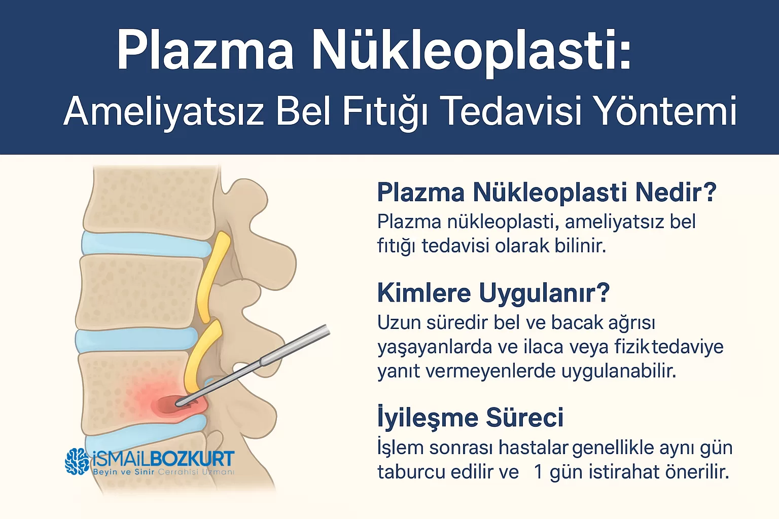 nükleoplasti ameliyatsız bel fıtık ankara plasma lazer